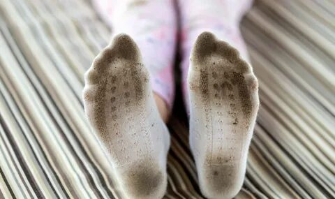 Sweaty socks feet