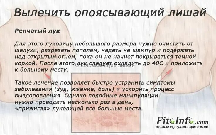 Опоясывающий лишай как выглядит и чем лечить Картинки ГЕРПЕС ИНКУБАЦИОННЫЙ ПЕРИОД