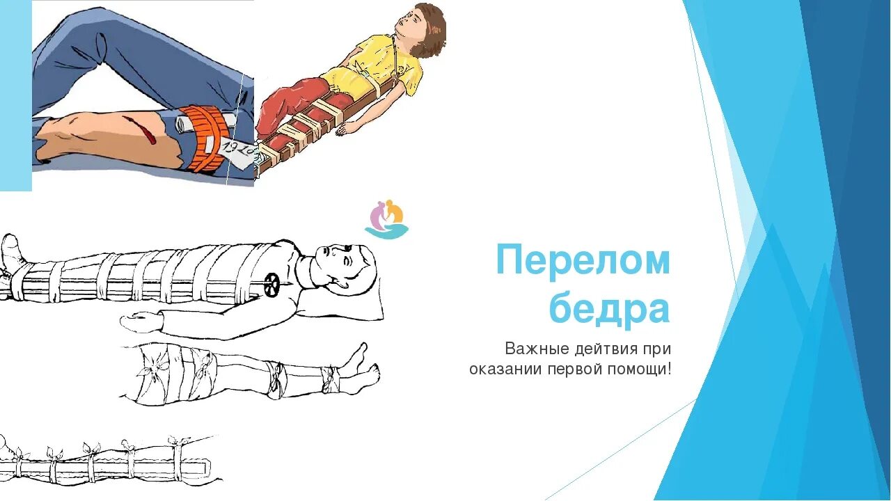 Оказание помощи при переломах костей. Транспортировка при переломах. Последовательность первой помощи при открытом переломе. Транспортировка больного при переломе бедра. Транспортировка пострадавших при переломе верхних конечностей.