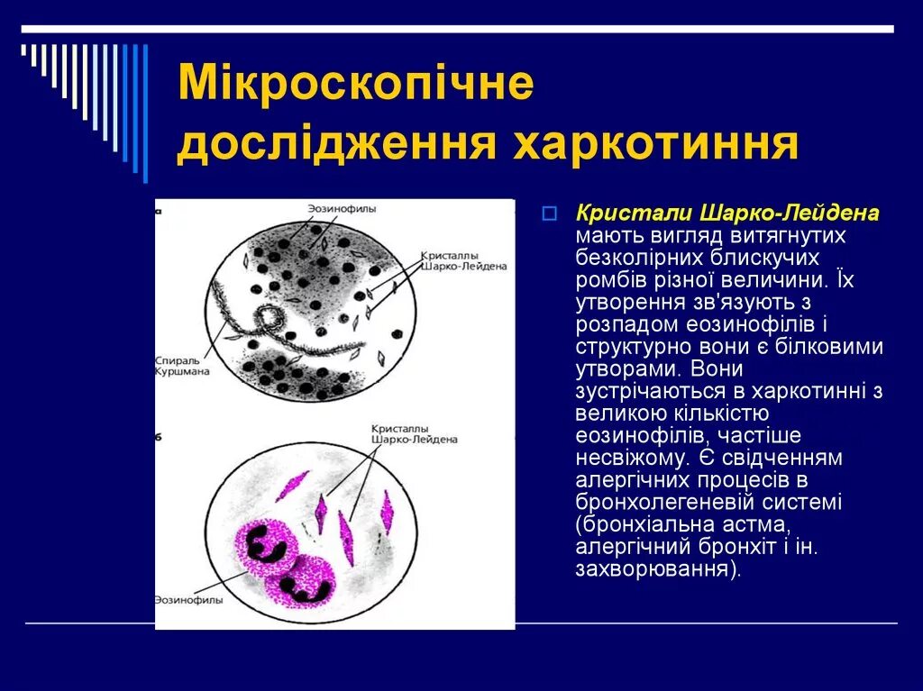 Кристаллы шарко в кале. Спирали Куршмана и Шарко Лейдена. Спирали Куршмана и Кристаллы Шарко-Лейдена. Спирали Куршмана, Кристаллы Шарко-Лейдена, эозинофилы. Спирали Куршмана и Кристаллы Шарко-Лейдена характерны для.