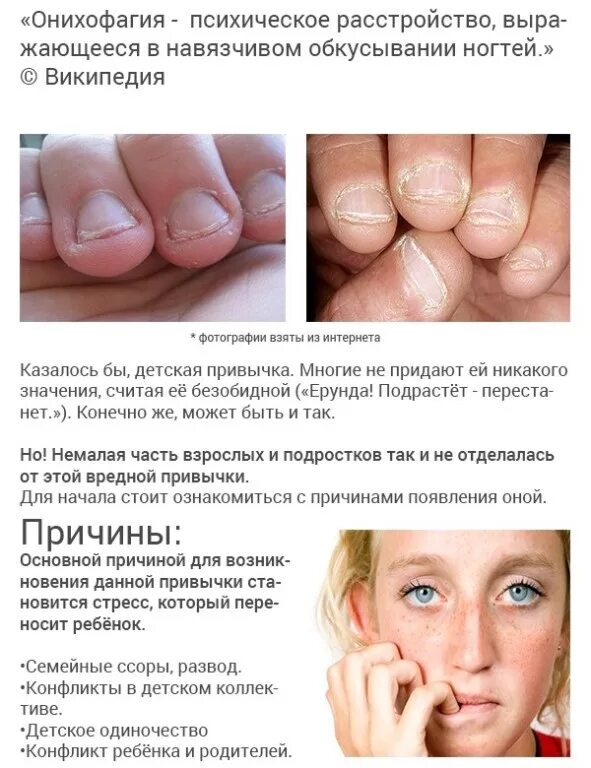 Грызть ногти вредная привычка. Грызть ногти психосоматика. Грызть ногти последствия. Вредные привычкигрыздь ногти.