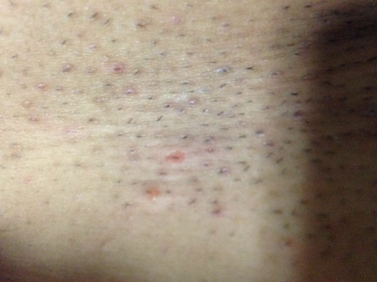 Запах у мужчины в интимной зоне причины