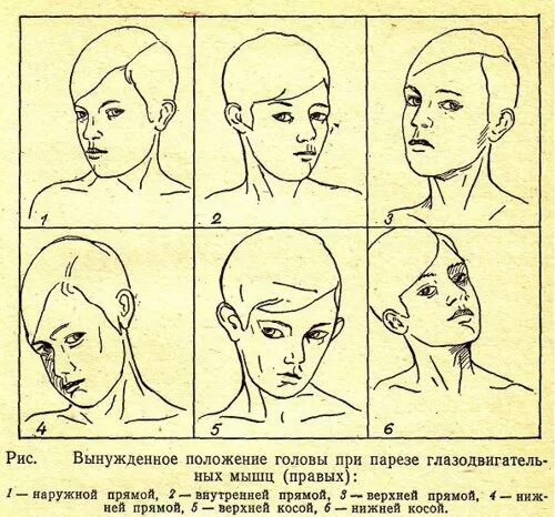 Изменение положения головы. Положение головы. вынужденное положение головы. исправление положения головы. положения головы названия.