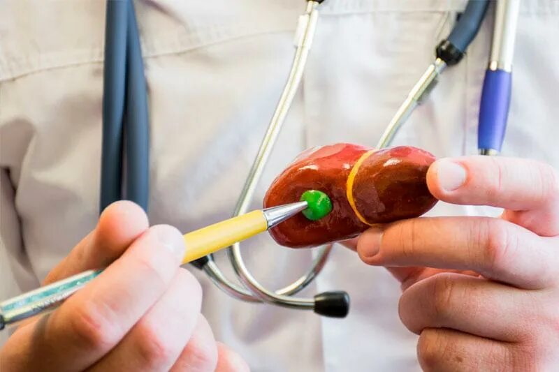 Камни в желчном пузыре 3 и 2 миллиметра. Камни в желчном пузыре 3 и 2 миллиметра. Удаление камней из желчного пузыря без операции. Операция дробление камней в желчном пузыре. Желчекаменная болезнь камни.