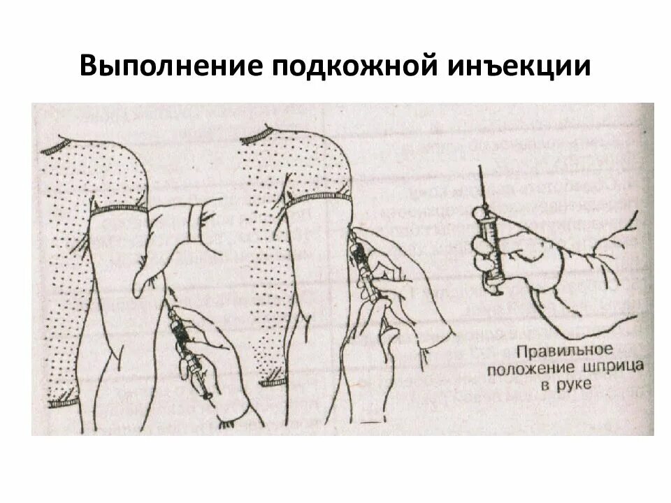 Вплоть выполнение