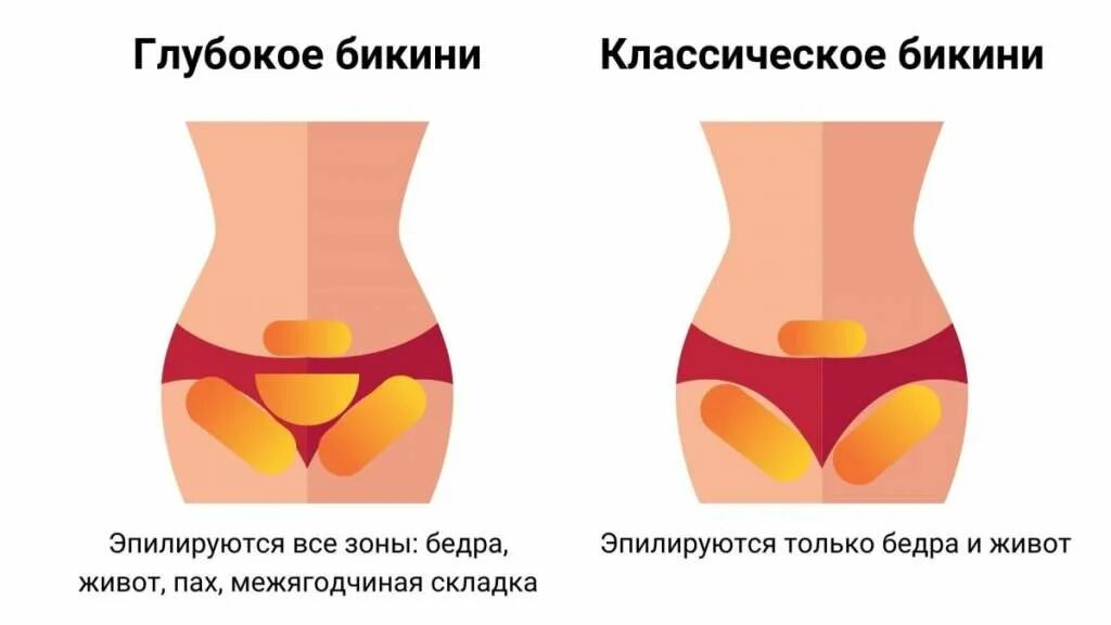 Чем отличается бикини от тотального бикини. Зона эпиляции классическое бикини. зона классического бикини шугаринг. бикини классика. эпиляция классическое бикини.