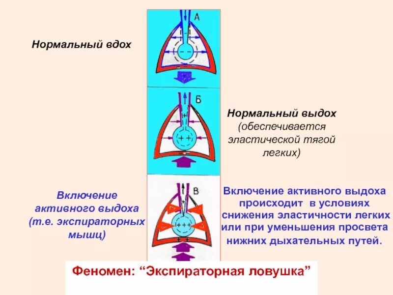 Вдох выдох выдох впр. Газовая ЛОВУШКА легких. Экспираторная ЛОВУШКА. Механизм вдоха и выдоха. Нормальный выдох происходит.