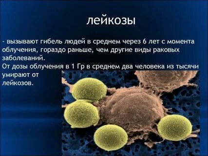Лучевая болезнь костный мозг