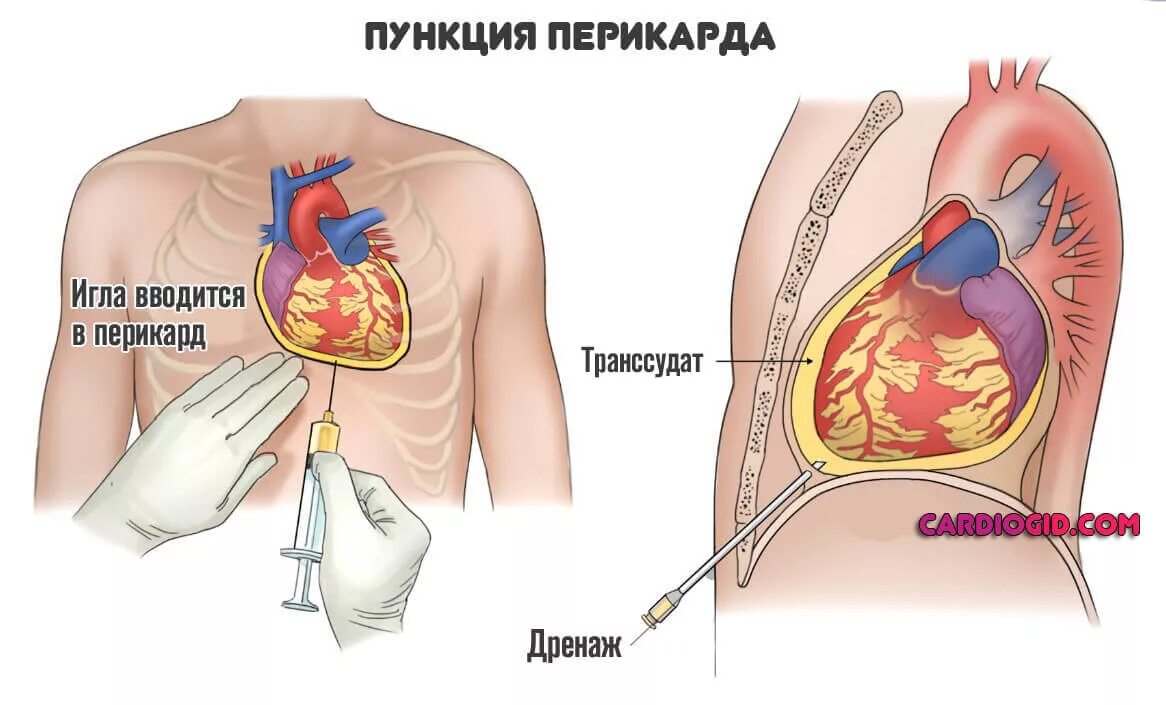 Фвб что это