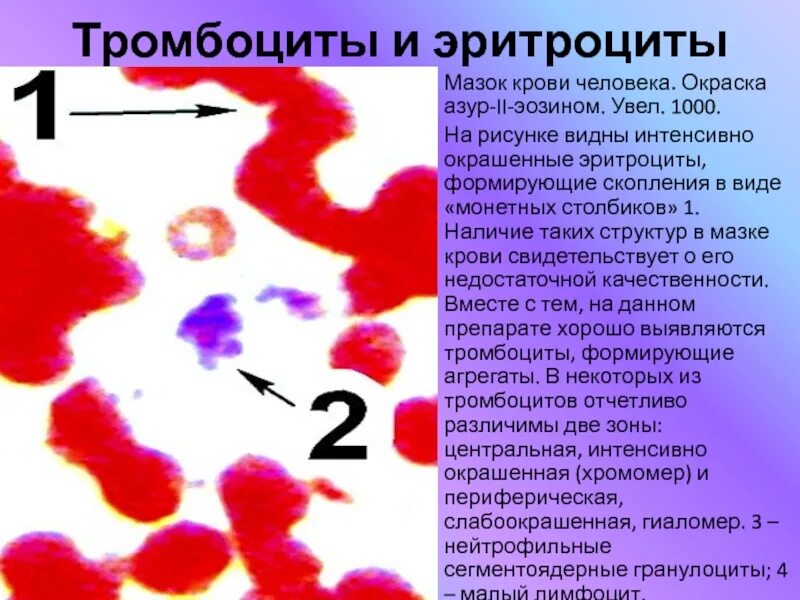 Причины увеличения эритроцитов. Причины увеличения эритроцитов