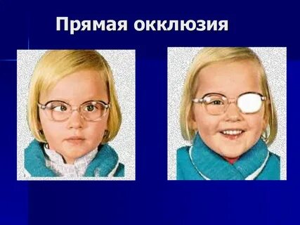 Окклюзия глаза