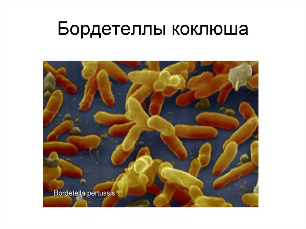 Коклюш bordetella pertussis