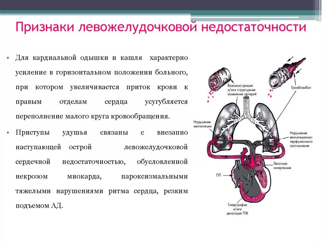 Признаки недостаточности легких. Признаки острой левожелудочковой недостаточности. Левожелудочковая недостаточность схема. Схема механизма левожелудочковой недостаточности. Острая левожелудочковая недостаточность гемодинамика.