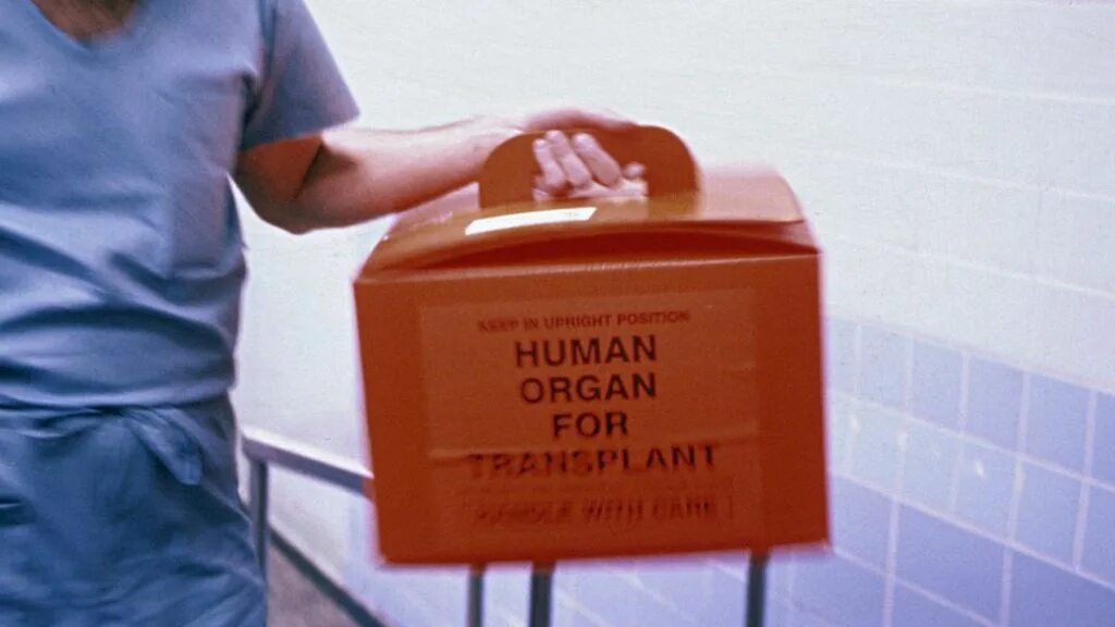 Изъятие органа у живого донора. Трансплантация органов и тканей. Пересадка органов человека. Транспортировка органов для трансплантации.