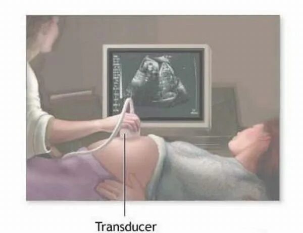 Сколько по времени делают узи. Трансабдоминальное УЗИ беременность. УЗИ трансабдоминальное при беременнос. Трансабдоминальный метод УЗИ малого таза. УЗИ при беременности трансабдоминально.
