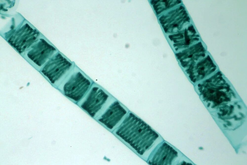 Спирогира представитель. Спирогира водоросль. Спирогира под микроскопом. Спирогира в микроскопе. Нитчатые зеленые водоросли.