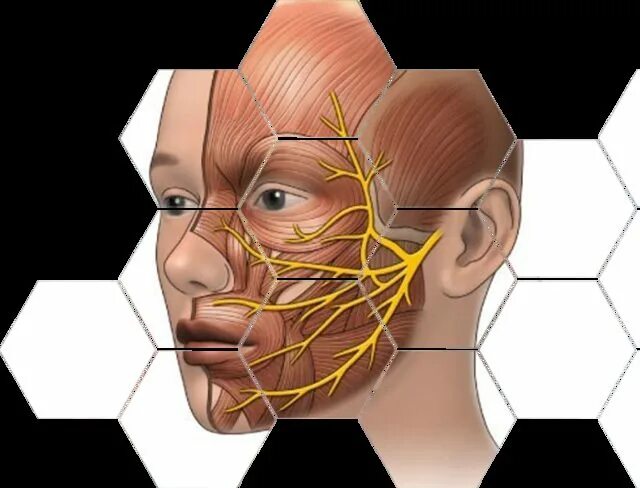 Блокада тройничного. Застудил тройничный нерв. Герпес тройничного нерва фото. Невралгия 1 ветви тройничного нерва. Воспаление тройничного лицевого нерва.