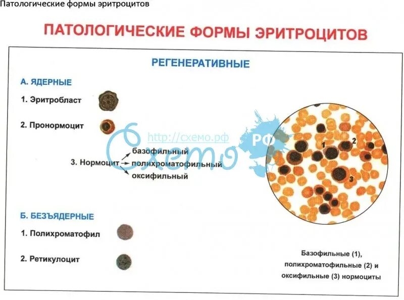Патологические формы эритроцитов. Патологические формы эритроцитов схема. патологические дегенеративные и регенеративные формы эритроцитов. регенеративные изменения эритроцитов. регенераторные формы эритроцитов это.