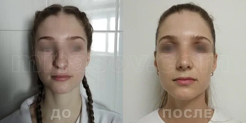 Трясет челюстью. Трясет челюстью