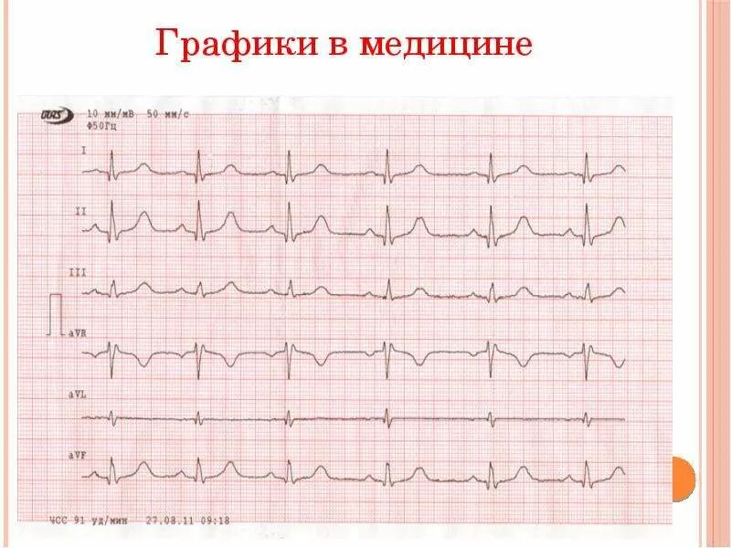 Медин график. Графики в медицине. графики в медицине примеры. графики функций в медицине. медицинские диаграммы.