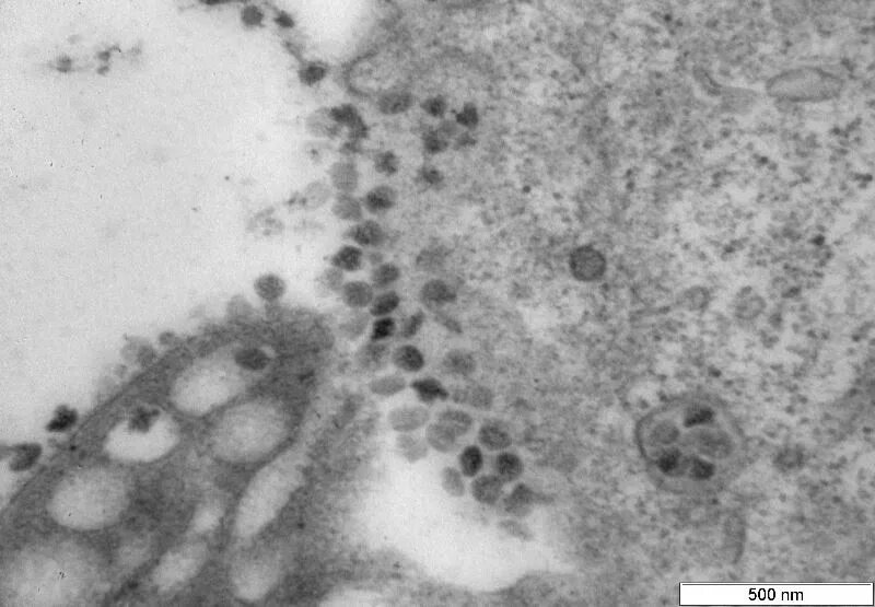 Коронавирус штаммы омикрон. Амикрон штамм фото вируса. Картинки Омикрон штамм. Культура клеток Vero фото. Омикрон проникновение в клетку.