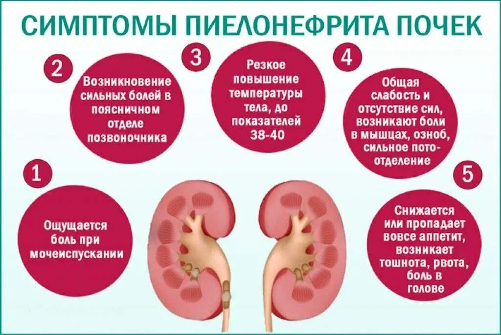 Заболевание пиелонефрит симптомы