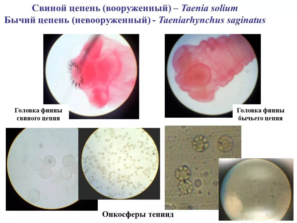 Финна бычьего цепня препарат. Финна бычьего цепня. Цистицерк бычьего цепня. Финна бычьего цепня. Финна (цистицерк) свиного цепня.