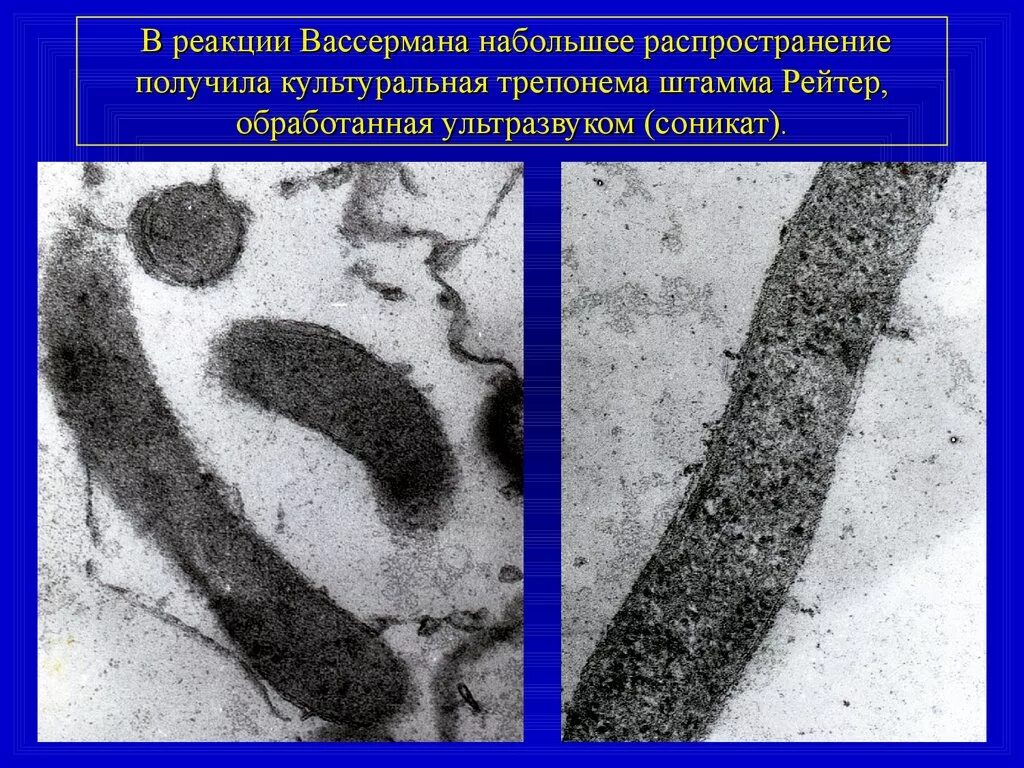 Реакция Вассермана. Реакция Вассермана сифилис. Реакция Вассермана механизм. РСК реакция Вассермана.