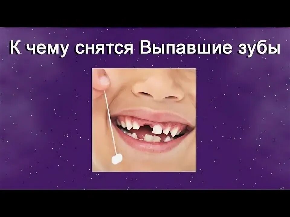 Сонник толкование выпавший зуб