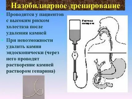 После удаления зонда