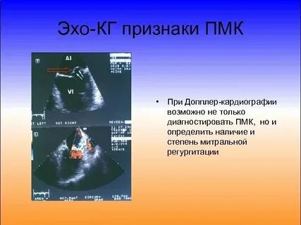 Пролапс передней стенки