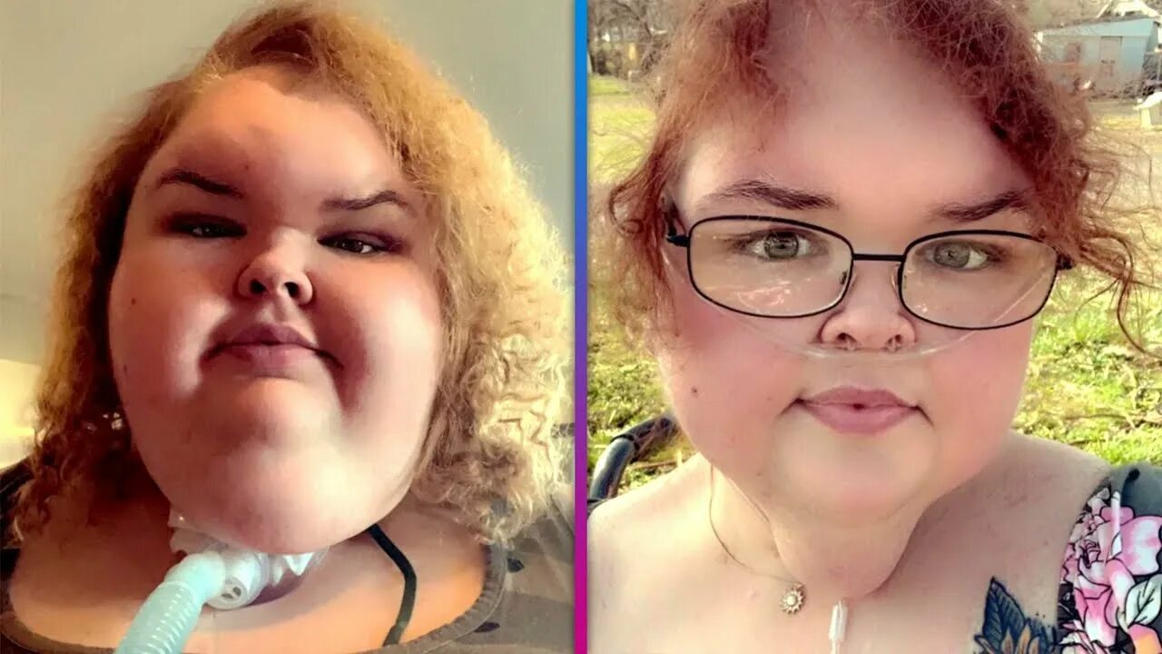 Tammy And Amy Slaton Before And After 1000lb Sisters... - YouTube