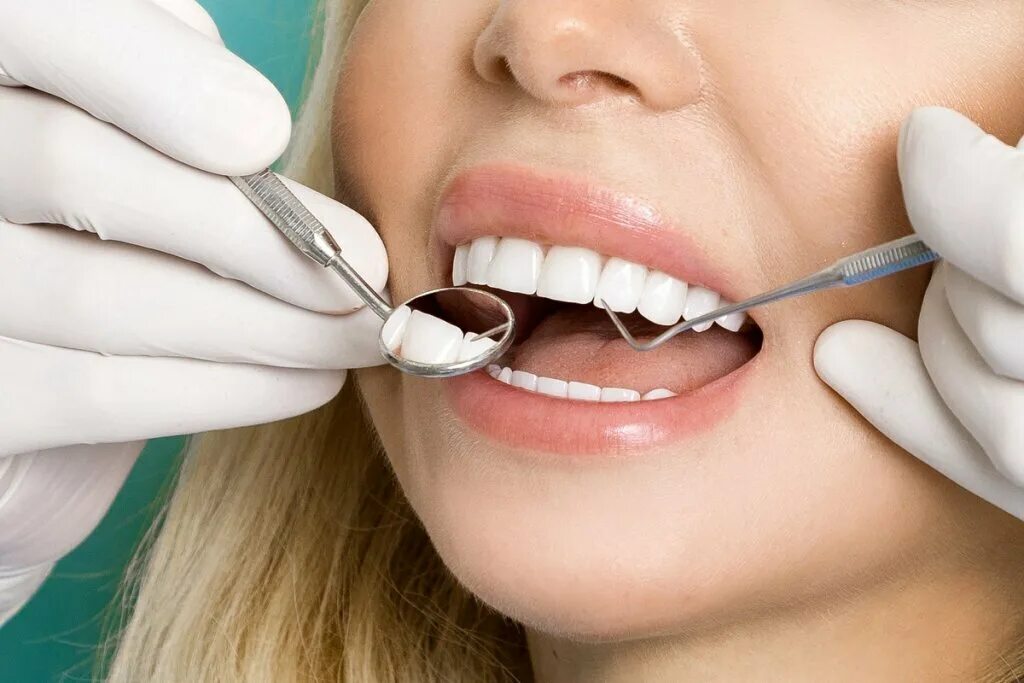 Сколько по времени делают зубы. Красивые зубы. Зубы стоматолог. Эстетическая стоматология. Профессиональная гигиена полости рта и зубов.
