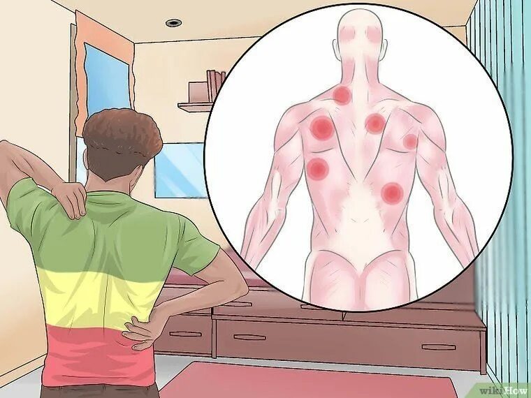 How is your back. Wiki how боль в спине. триггерные точки на спине. валик для массажа триггерных точек.