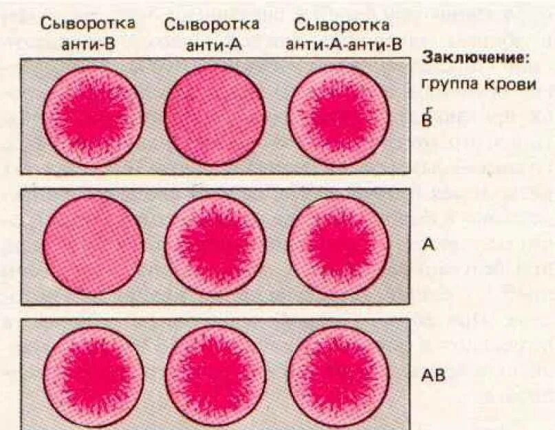 Редкая кровь группа и резус. Самая редкая группа крови. Редкие группы крови человека и резус фактор. Самый редкий резус-фактор крови.