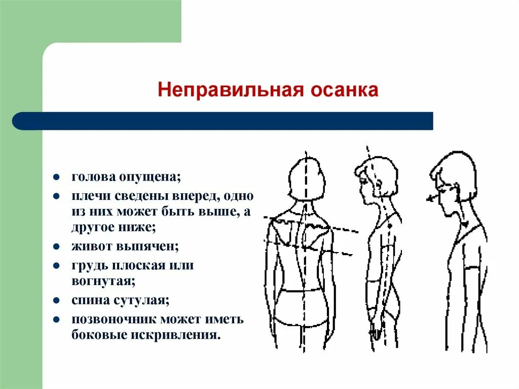 Неправильная осанка. Правильная осанка. Правильная и неправильная осанка. Презентация на тему осанка. Иметь голову на плечах 2 предложения