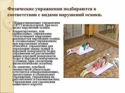 Корригирующие физические упражнения