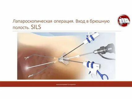 Что нельзя после лапароскопии
