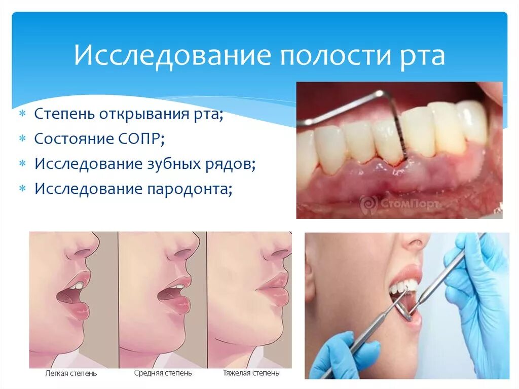 Исследование ротовой полости. Степень открывания рта. Исследование полости рта. Степень открывания р а. Оценить степень открывания рта.