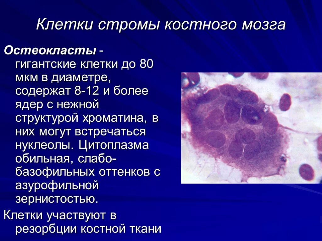 Тип стромы в