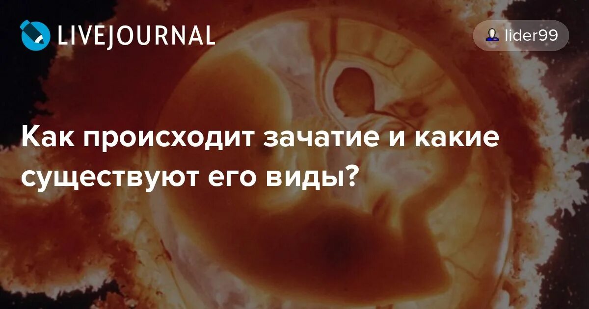 Когда происходит зачатие на какой день. Как происходит зачатие ребенка. как происходит момент зачатия. процесс зачатия анимация.