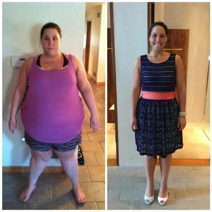 Снижение веса после. Похудение до и после. Результаты похудения. Похудение на редуксине до и после. До и после похудения девушки.