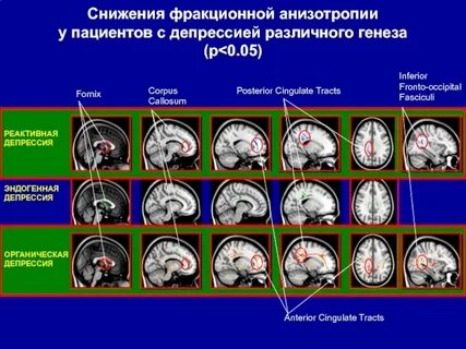 Сосудистый центр головного мозга