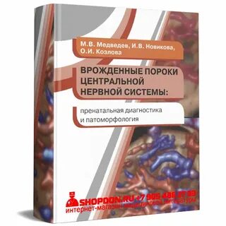 Врожденный порок цнс