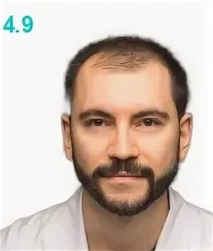 Алиев вугар ильгарович. Вугар алиев пермь. Алиев вугар ильгарович пластический хирург. Вугар алиев. Вугар алиев 1969.