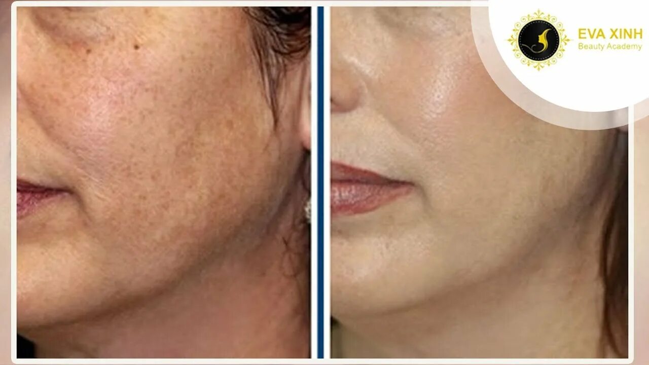 This Woman’s Before-and-After Sun Damage Photo Is Going Viral