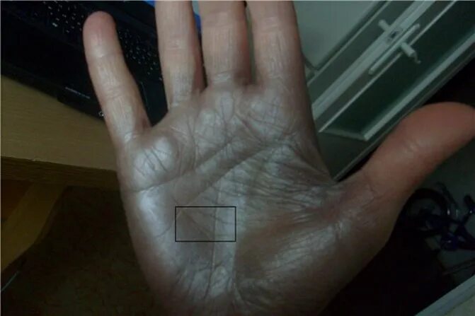 Холм аполлона хиромантия. Знаки на ладони. Знак ведьмы на ладони. Отметины дьявола на руке. Родина на левой ладони.