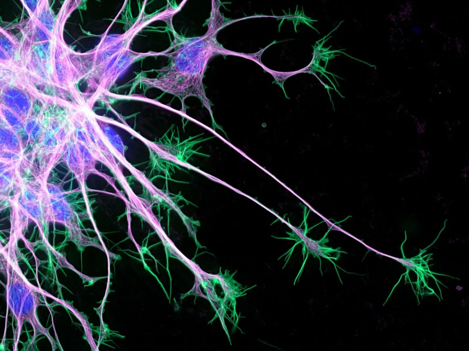 Мозг человека состоит из нейронов. Веретеновидные Нейроны. Микротрубочки нейрона. Нейрон клетка головного мозга. NCNA Нейроны.