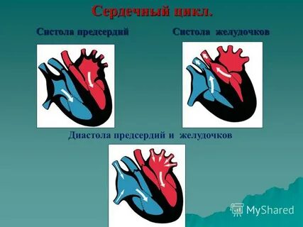Систола