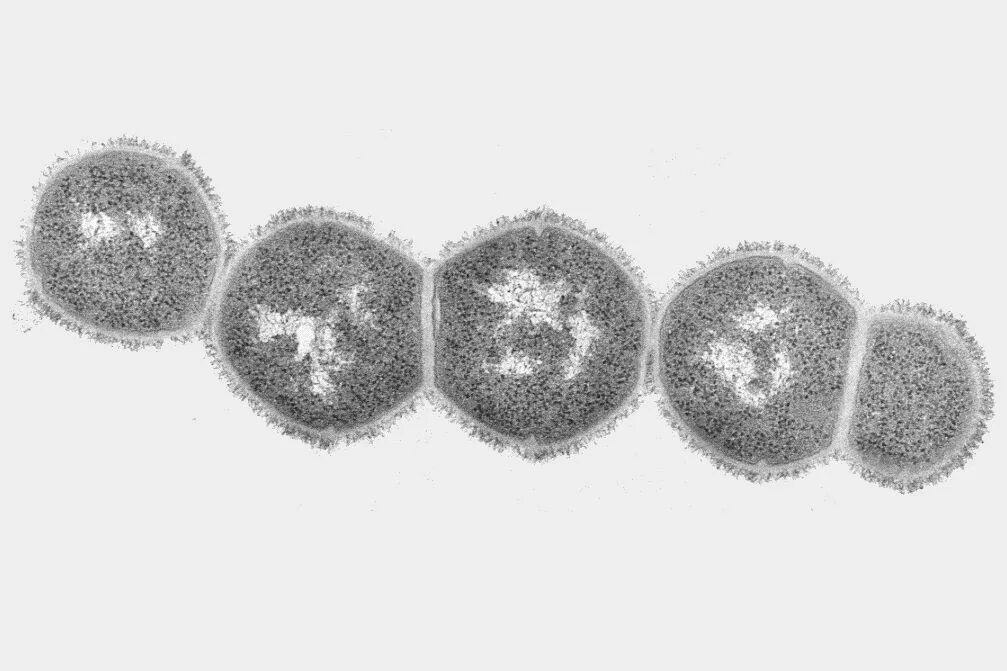 Возбудитель скарлатины является. Streptococcus pyogenes возбудитель скарлатины. Возбудитель скарлатины микробиология. Streptococcus pyogenes электронная микроскопия. Скарлатинозный стрептококк.